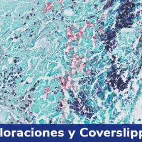 Coloraciones_y_Coverslipper_Rochem_Biocare