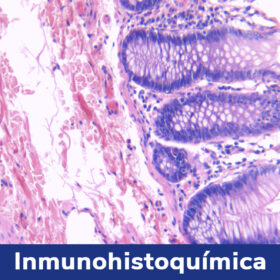 Inmunohistoquímica_Rochem_Biocare