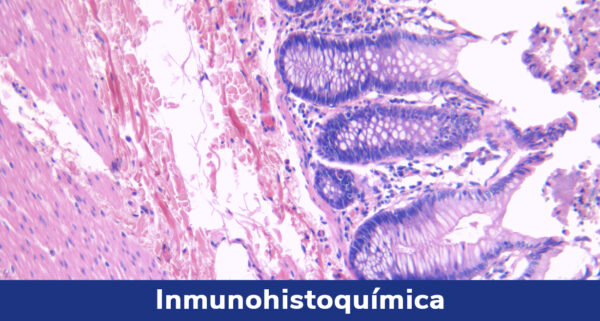 Inmunohistoquímica_Rochem_Biocare